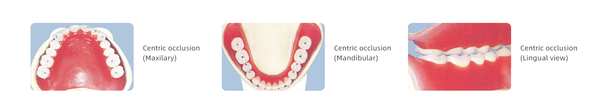 china dental materials