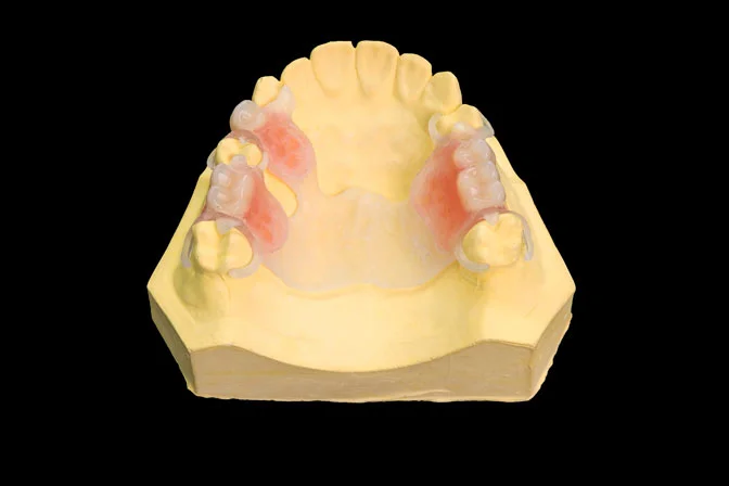 partial denture material