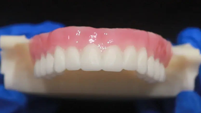 Fabricate Your Digital Denture Using the Stain Method