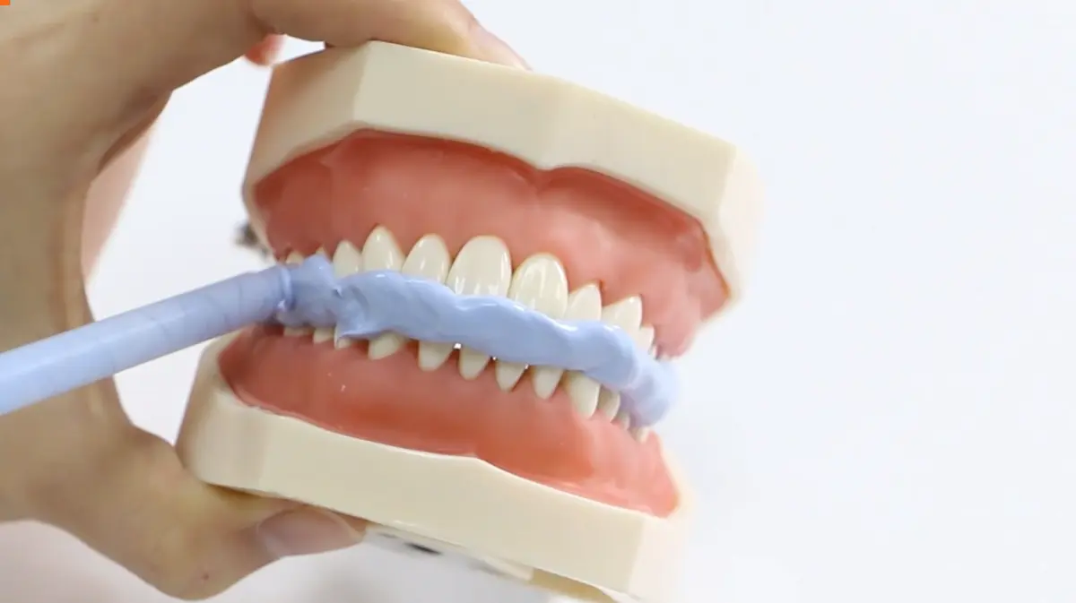Accurate Bite Registration - Help to Create Perfect Restorations