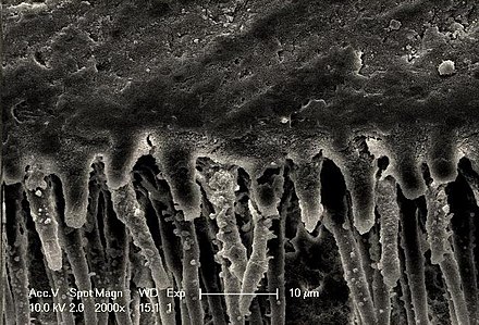 Resin-dentin_interface_indicating_a_hybrid_layer.jpg